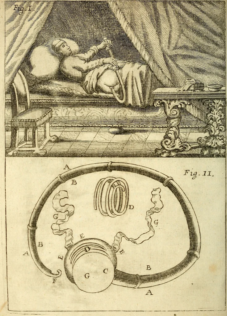 An illustration from Michaelis Bernhardi Valentini prof. medici ... Polychresta exotica in curandis affectibus contumacissimis probatissima ... : ut et nova herniarum cura. Accedunt seorsim olim editae ... Dissertationes epistolicae varii argumenti .., 1700, leaf 105