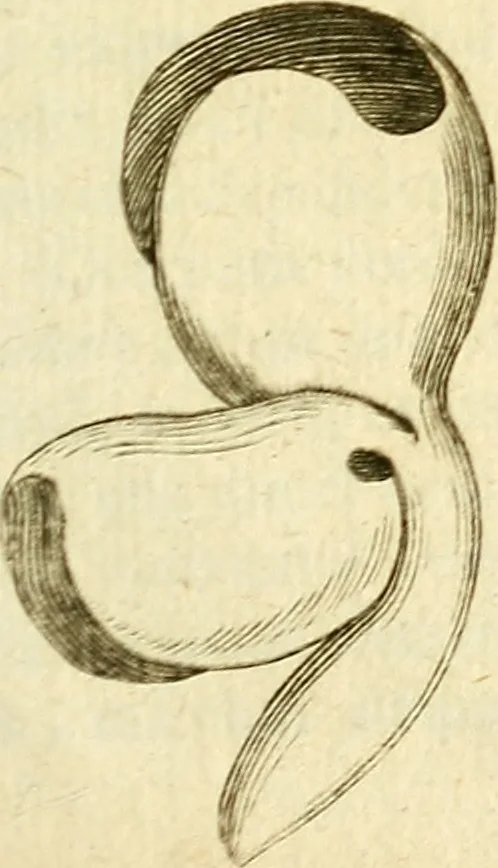 An illustration from Michaelis Bernhardi Valentini prof. medici ... Polychresta exotica in curandis affectibus contumacissimis probatissima ... : ut et nova herniarum cura. Accedunt seorsim olim editae ... Dissertationes epistolicae varii argumenti .., 1700, leaf 140