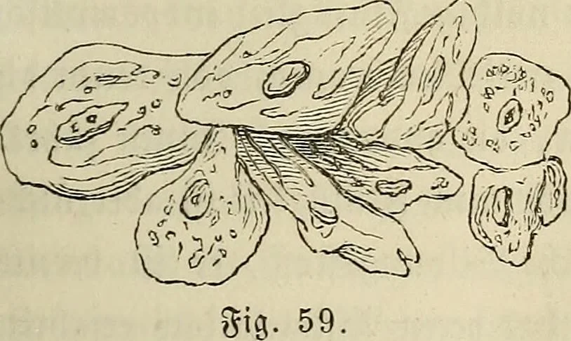 An illustration from Mikroskopische Bilder : Naturansichten aus dem kleinsten Raume ; ein Gemälde des Mikrokosmus in seinen Gestalten und Gesetzen, 1853, leaf 188