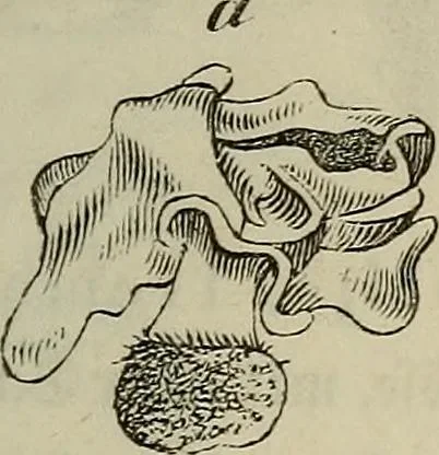 An illustration from Mikroskopische Bilder : Naturansichten aus dem kleinsten Raume ; ein Gemälde des Mikrokosmus in seinen Gestalten und Gesetzen, 1853, leaf 424