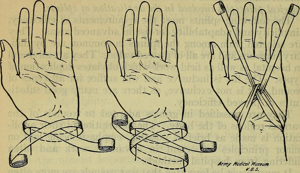 An illustration from Military surgery of the zone of the advance, 1918, leaf 239