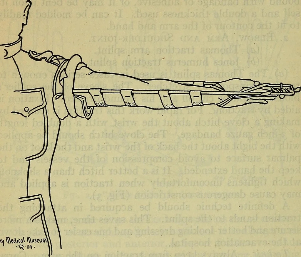 An illustration from Military surgery of the zone of the advance, 1918, leaf 241