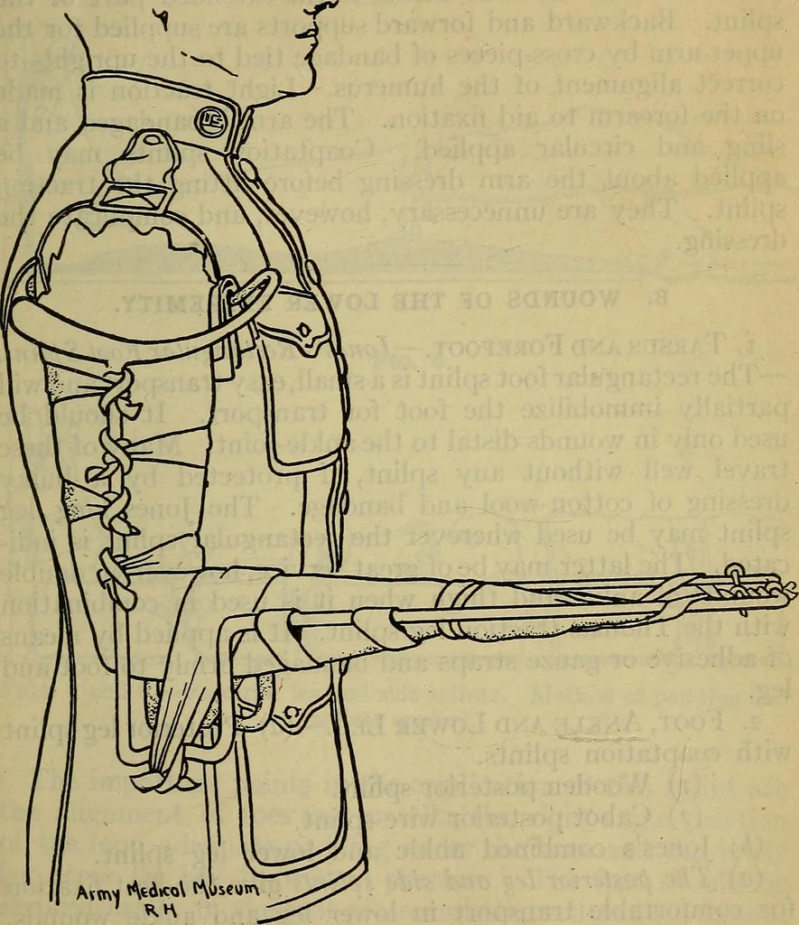 An illustration from Military surgery of the zone of the advance, 1918, leaf 242