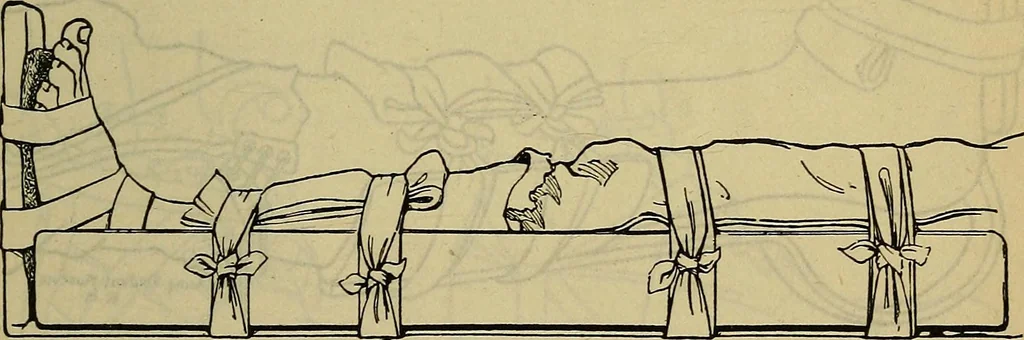 An illustration from Military surgery of the zone of the advance, 1918, leaf 244