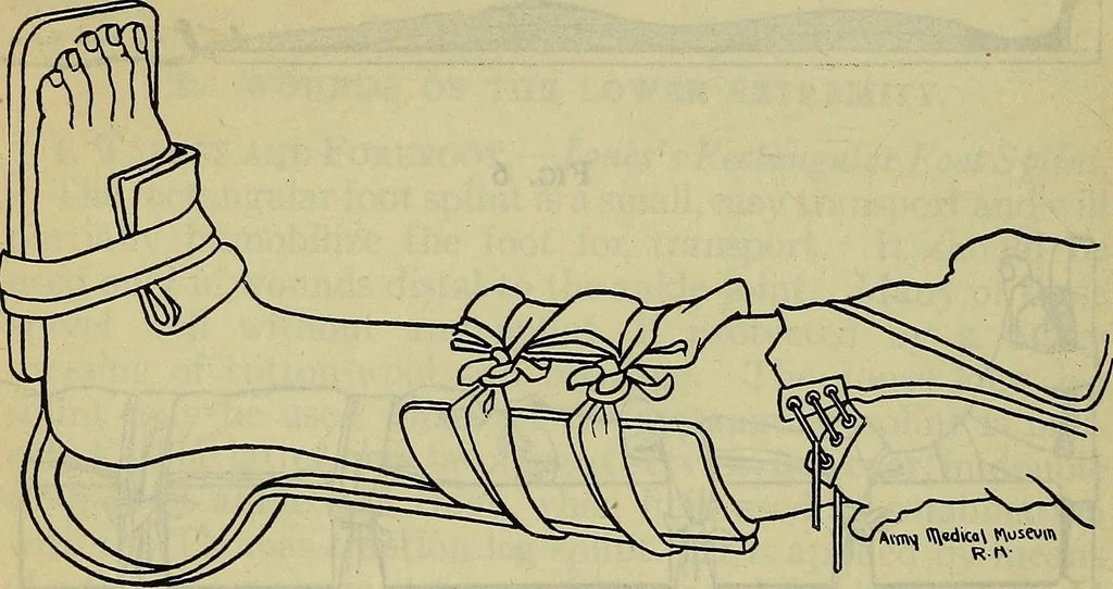 An illustration from Military surgery of the zone of the advance, 1918, leaf 245