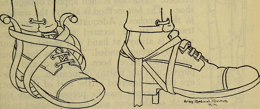 An illustration from Military surgery of the zone of the advance, 1918, leaf 246