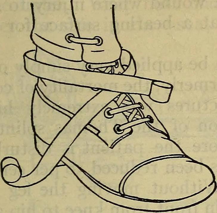 An illustration from Military surgery of the zone of the advance, 1918, leaf 246