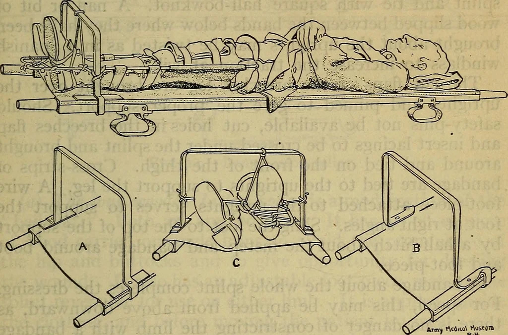 An illustration from Military surgery of the zone of the advance, 1918, leaf 248