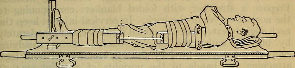 An illustration from Military surgery of the zone of the advance, 1918, leaf 250