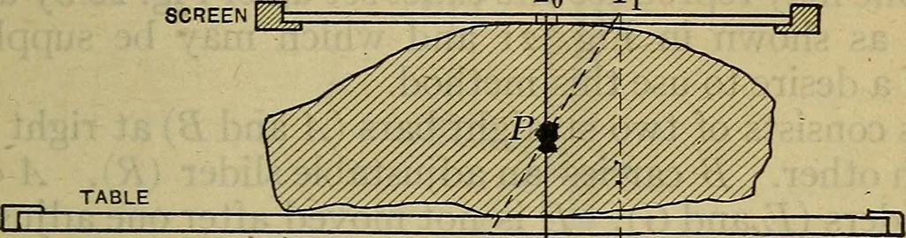 An illustration from Military surgery of the zone of the advance, 1918, leaf 290