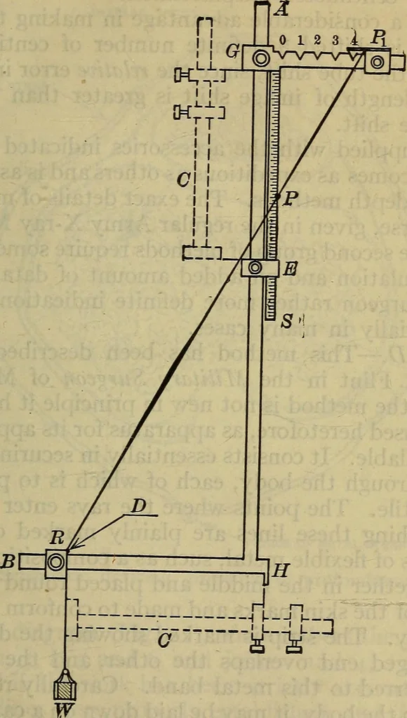 An illustration from Military surgery of the zone of the advance, 1918, leaf 292