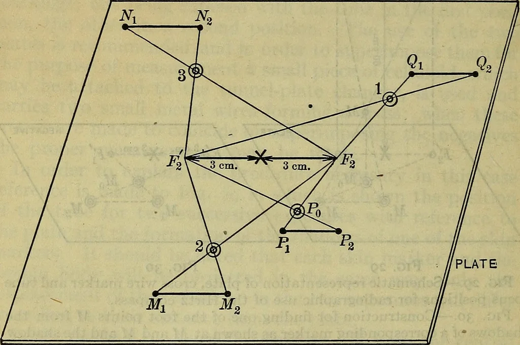 An illustration from Military surgery of the zone of the advance, 1918, leaf 309