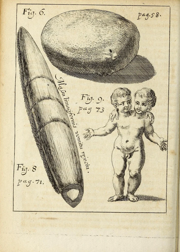 An illustration from Miscellanea Curiosa, sive Ephemiridum Medico-Physicarum Germanicarum Academiae Naturae Curiosorum, 1692, leaf 116
