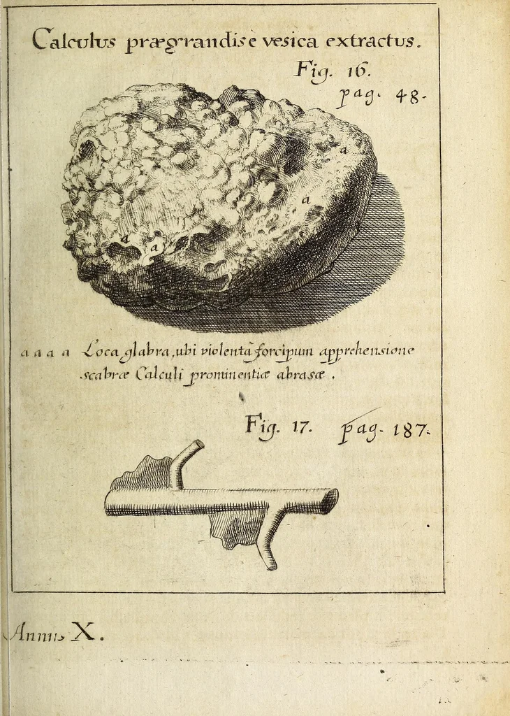 An illustration from Miscellanea Curiosa, sive Ephemiridum Medico-Physicarum Germanicarum Academiae Naturae Curiosorum, 1692, leaf 89