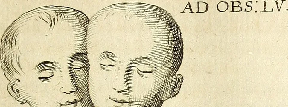 An illustration from Miscellanea Curiosa Medico-Physica Academiae Naturae Curiosorum, 1670, leaf 198