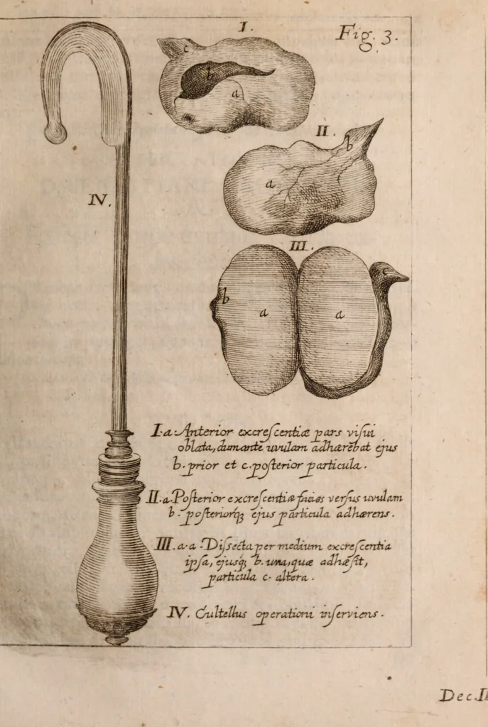 An illustration from Miscellanea curiosa, sive, Ephemeridum medico-physicarum Germanicarum Academiae Naturae curiosorum, 1683, leaf 102