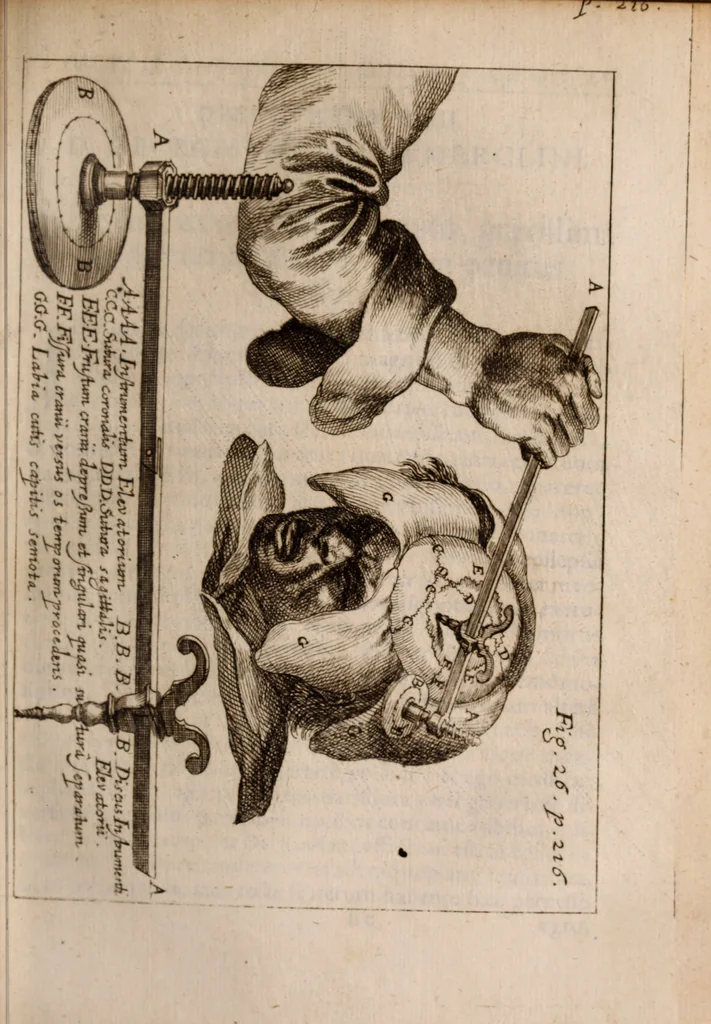 An illustration from Miscellanea curiosa, sive, Ephemeridum medico-physicarum Germanicarum Academiae Naturae curiosorum, 1683, leaf 320