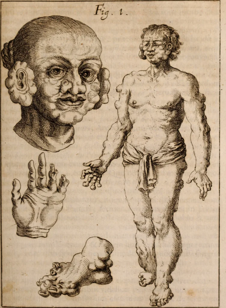 An illustration from Miscellanea curiosa, sive, Ephemeridum medico-physicarum Germanicarum Academiae Naturae curiosorum, 1683, leaf 756