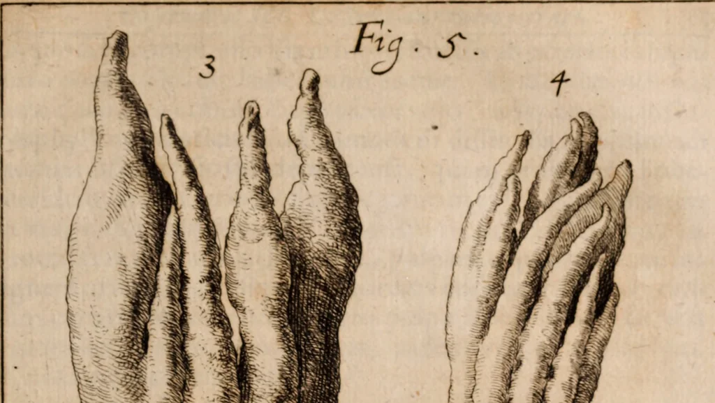 An illustration from Miscellanea curiosa, sive, Ephemeridum medico-physicarum Germanicarum Academiae Naturae curiosorum, 1683, leaf 790