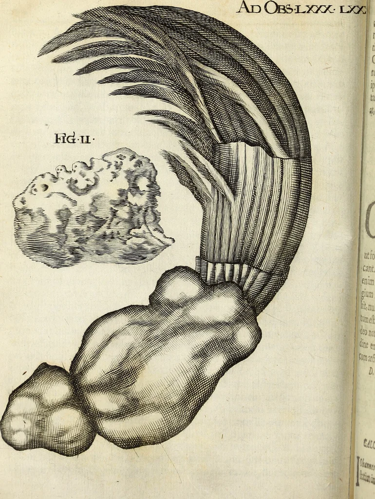 An illustration from Miscellanea Curiosa Medico-Physica Academiae Naturae Curiosorum, 1671, leaf 269