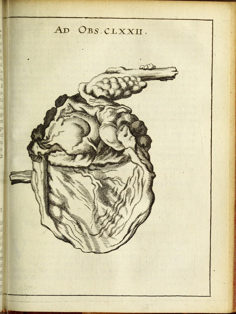 An illustration from Miscellanea Curiosa Medico-Physica Academiae Naturae Curiosorum, 1671, leaf 412