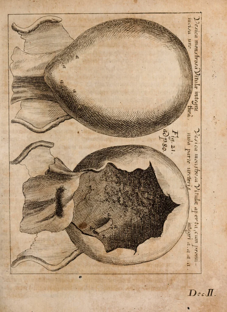 An illustration from Miscellanea curiosa, sive, Ephemeridum medico-physicarum Germanicarum Academiae Naturae curiosorum, 1688, leaf 1372