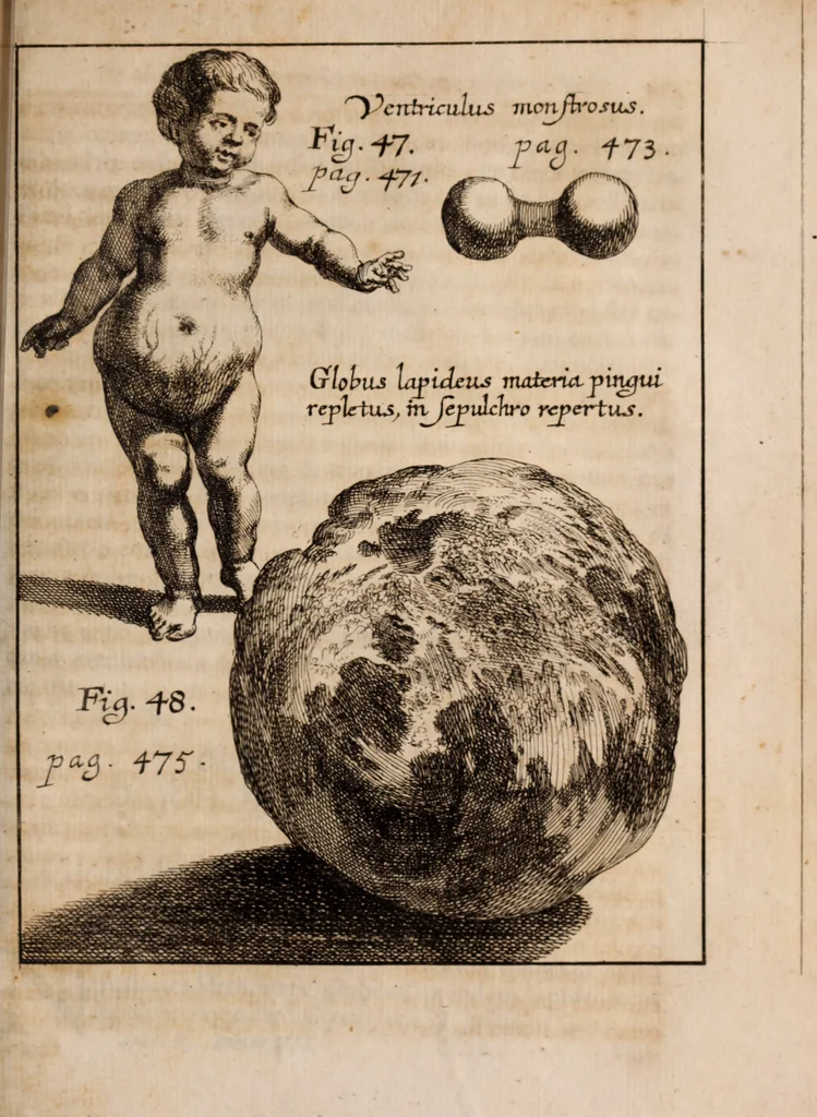 An illustration from Miscellanea curiosa, sive, Ephemeridum medico-physicarum Germanicarum Academiae Naturae curiosorum, 1688, leaf 1792