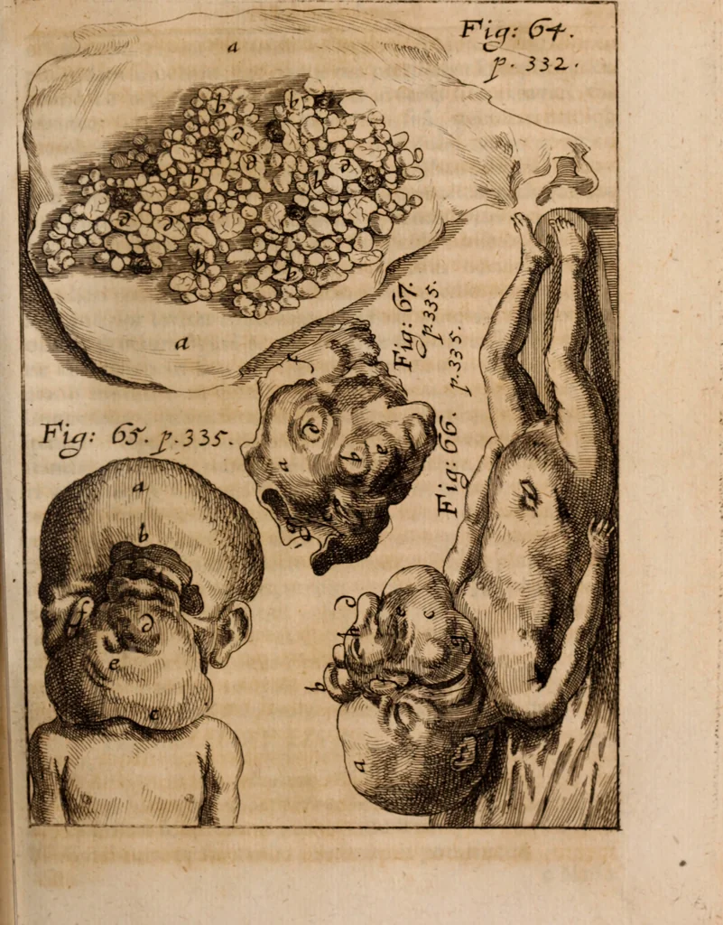 An illustration from Miscellanea curiosa, sive, Ephemeridum medico-physicarum Germanicarum Academiae Naturae curiosorum, 1688, leaf 416