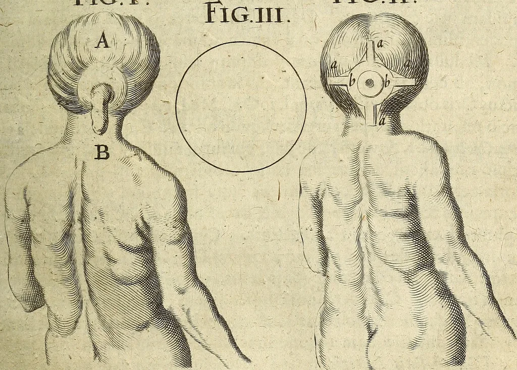 An illustration from Miscellanea Curiosa Medico-Physica Academiae Naturae Curiosorum, 1672, leaf 112