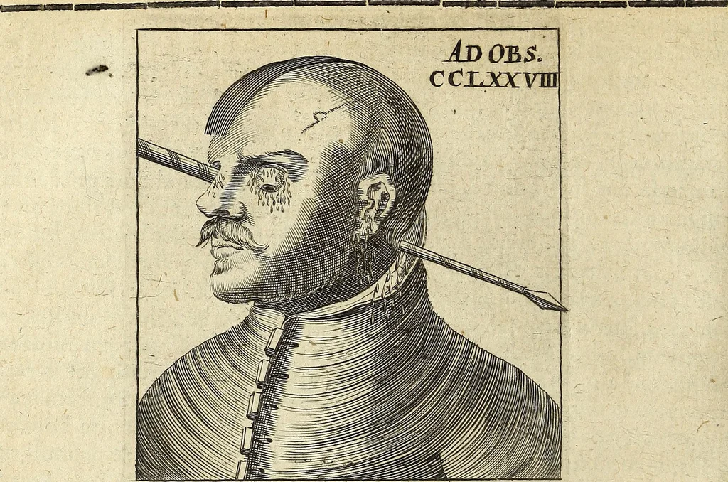 An illustration from Miscellanea Curiosa Medico-Physica Academiae Naturae Curiosorum, 1672, leaf 565