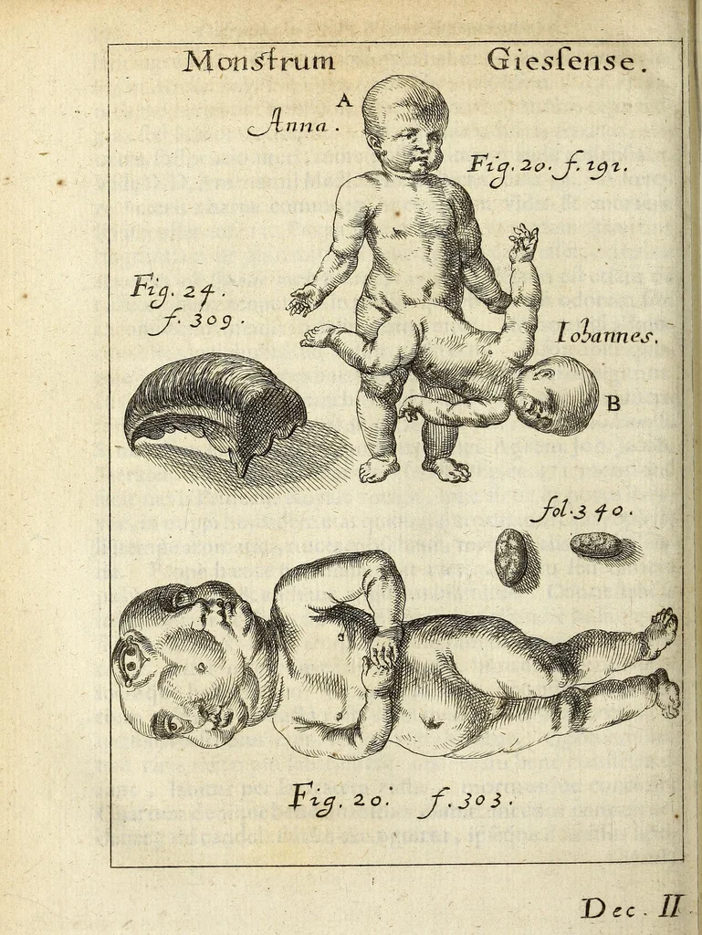 An illustration from Miscellanea Curiosa, sive Ephemiridum Medico-Physicarum Germanicarum Academiae Naturae Curiosorum, 1685, leaf 374