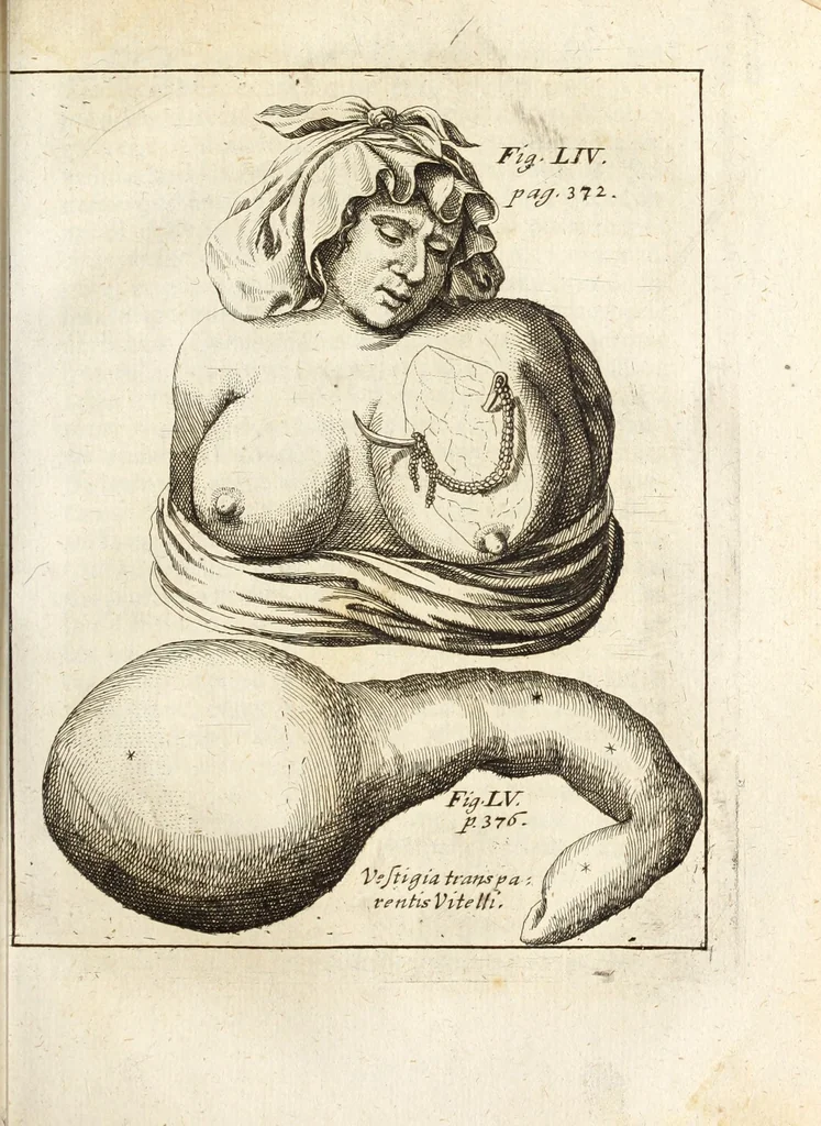 An illustration from Miscellanea curiosa, sive, Ephemeridum medico-physicarum Germanicarum, 1700, leaf 456
