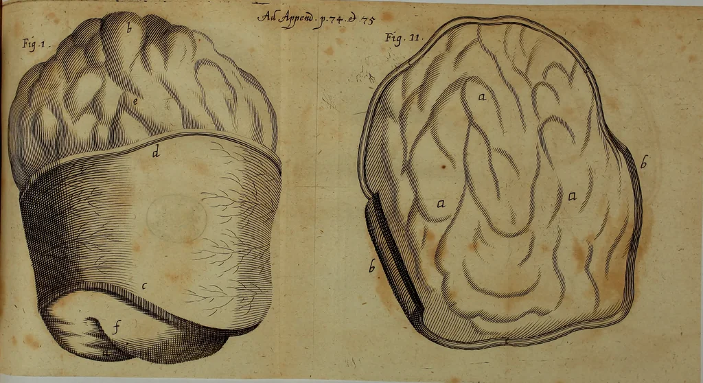 An illustration from Miscellanea Curiosa Medico-Physica Academiae Naturae Curiosorum, 1676, leaf 470