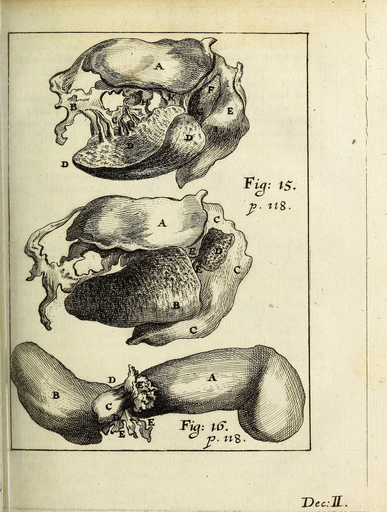 An illustration from Miscellanea Curiosa, sive Ephemiridum Medico-Physicarum Germanicarum Academiae Naturae Curiosorum, 1687, leaf 171