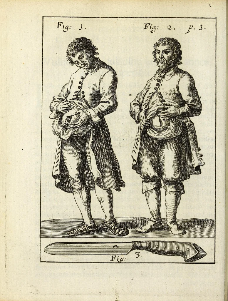 An illustration from Miscellanea Curiosa, sive Ephemiridum Medico-Physicarum Germanicarum Academiae Naturae Curiosorum, 1687, leaf 36