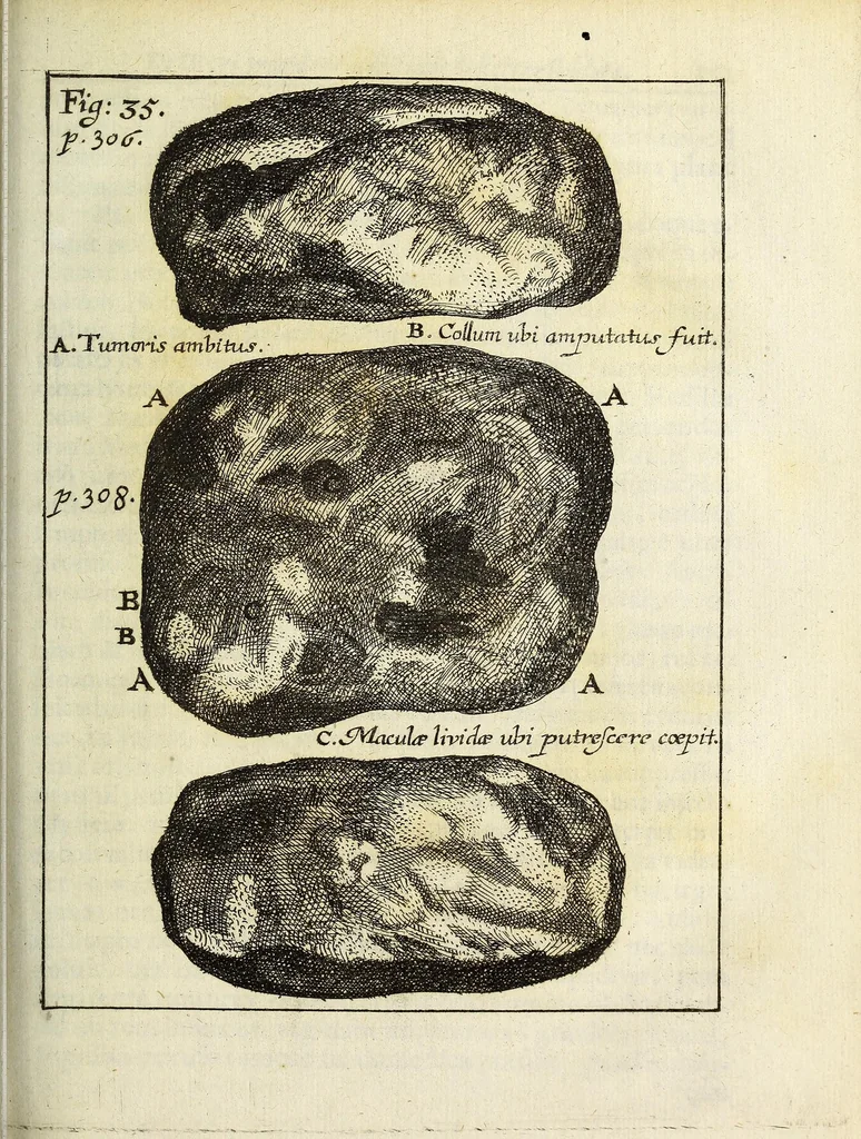 An illustration from Miscellanea Curiosa, sive Ephemiridum Medico-Physicarum Germanicarum Academiae Naturae Curiosorum, 1687, leaf 385