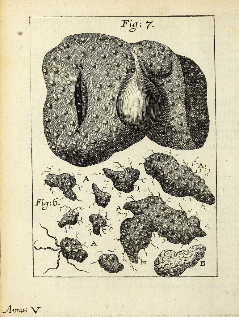 An illustration from Miscellanea Curiosa, sive Ephemiridum Medico-Physicarum Germanicarum Academiae Naturae Curiosorum, 1687, leaf 620