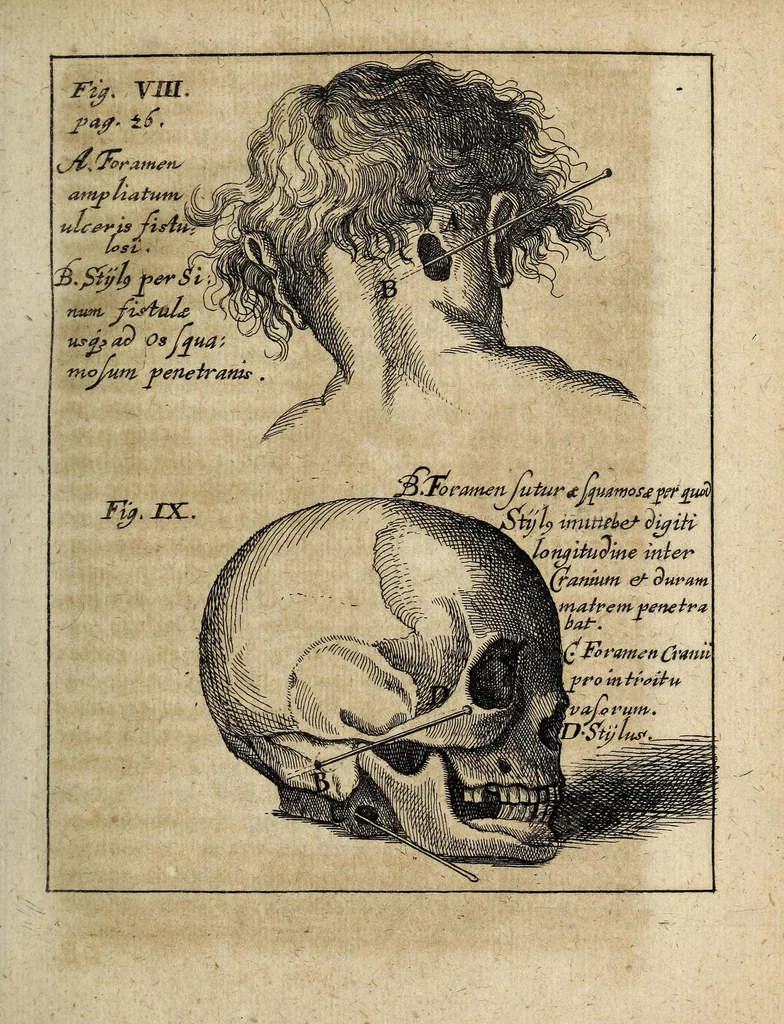 An illustration from Miscellanea Curiosa, sive Ephemiridum Medico-Physicarum Germanicarum Academiae Naturae Curiosorum, 1700, leaf 49