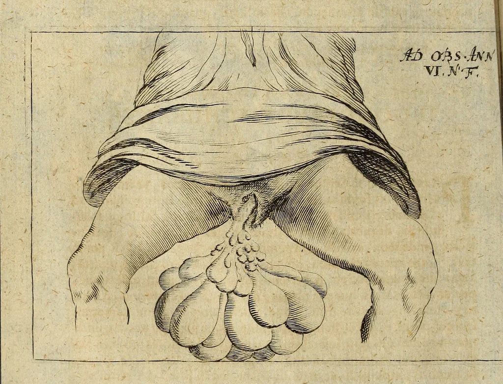 An illustration from Miscellanea Curiosa Medico-Physica Academiae Naturae Curiosorum, 1677, leaf 59