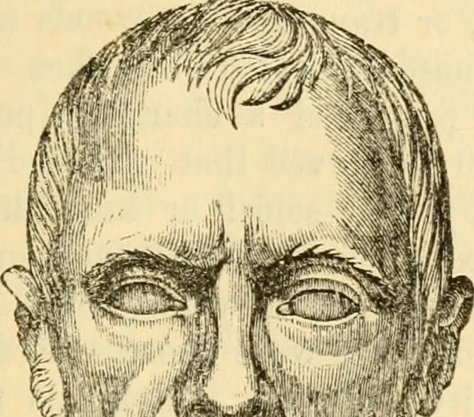 An illustration from My battle for life. The autobiography of a phrenologist, 1857, leaf 350