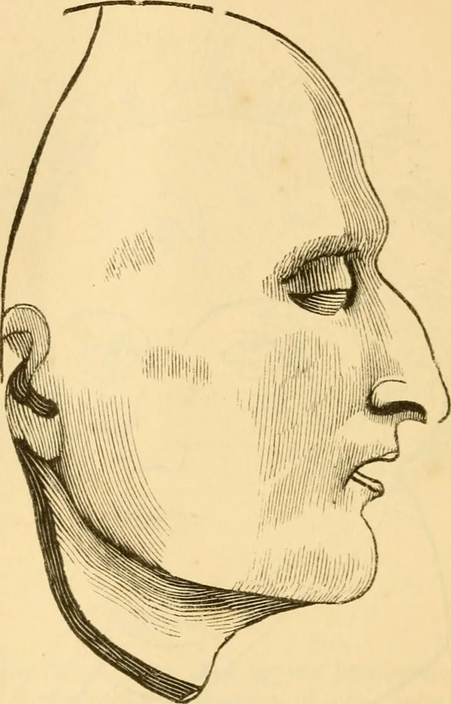 An illustration from My battle for life. The autobiography of a phrenologist, 1857, leaf 359