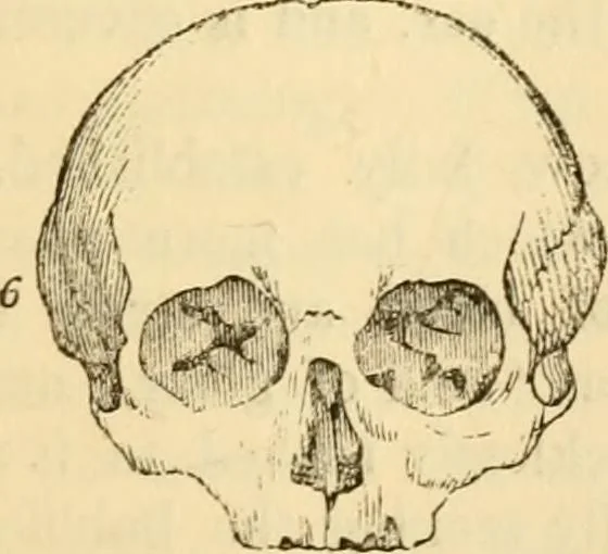 An illustration from My battle for life. The autobiography of a phrenologist, 1857, leaf 518