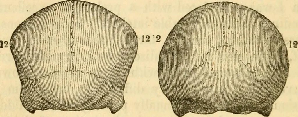An illustration from My battle for life. The autobiography of a phrenologist, 1857, leaf 679