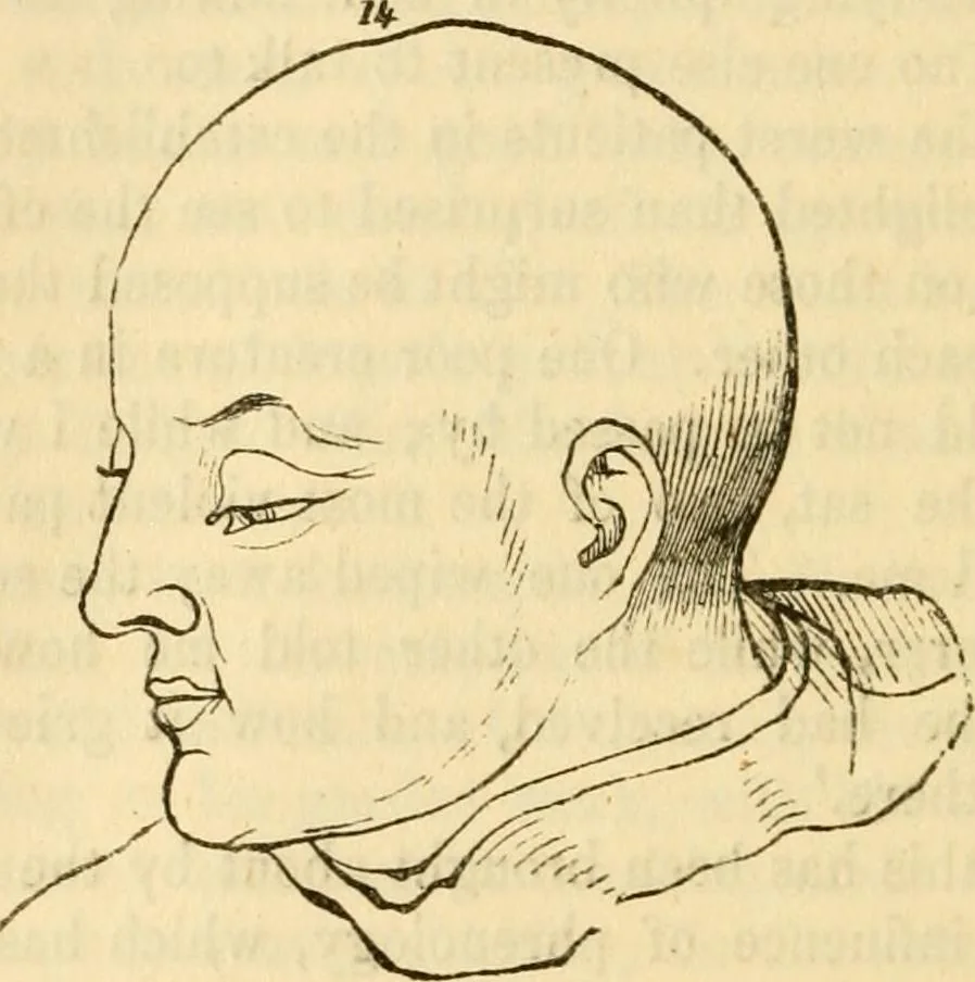 An illustration from My battle for life. The autobiography of a phrenologist, 1857, leaf 687
