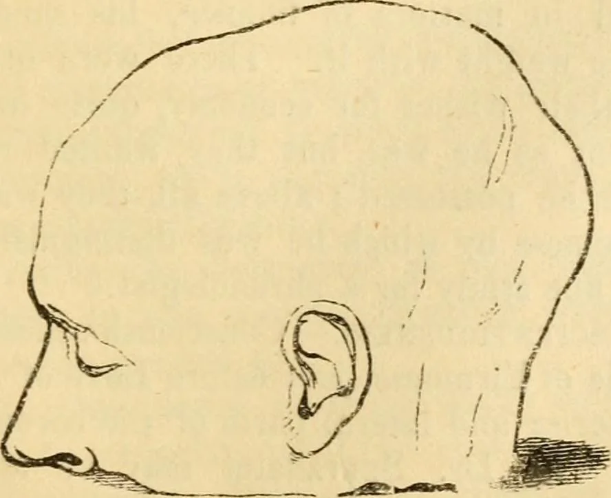 An illustration from My battle for life. The autobiography of a phrenologist, 1857, leaf 692