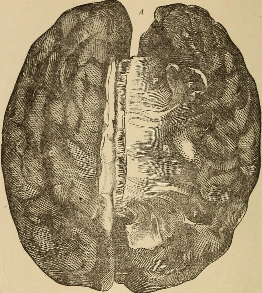 An illustration from The mysteries of the head and the heart explained : including an improved system of phrenology, a new theory of the emotions, and an explanation of the mysteries of mesmerism, trance, mind-reading, and the spirit delusion, 1875, leaf 183