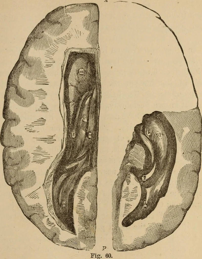 An illustration from The mysteries of the head and the heart explained : including an improved system of phrenology, a new theory of the emotions, and an explanation of the mysteries of mesmerism, trance, mind-reading, and the spirit delusion, 1875, leaf 196