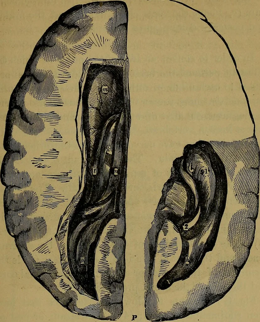 An illustration from The mysteries of the head and the heart explained: including an improved system of phrenology; a new theory of the emotions, and an explanation of the mysteries of mesmerism, trance, mind-reading, and the spirit delusion, 1881, leaf 198