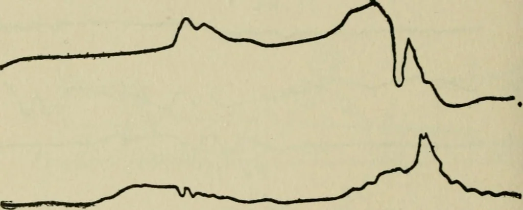 An illustration from Mystrious psychic forces; an account of the author's invesigations in psychical research, together with those of other European savants, 1907, leaf 381