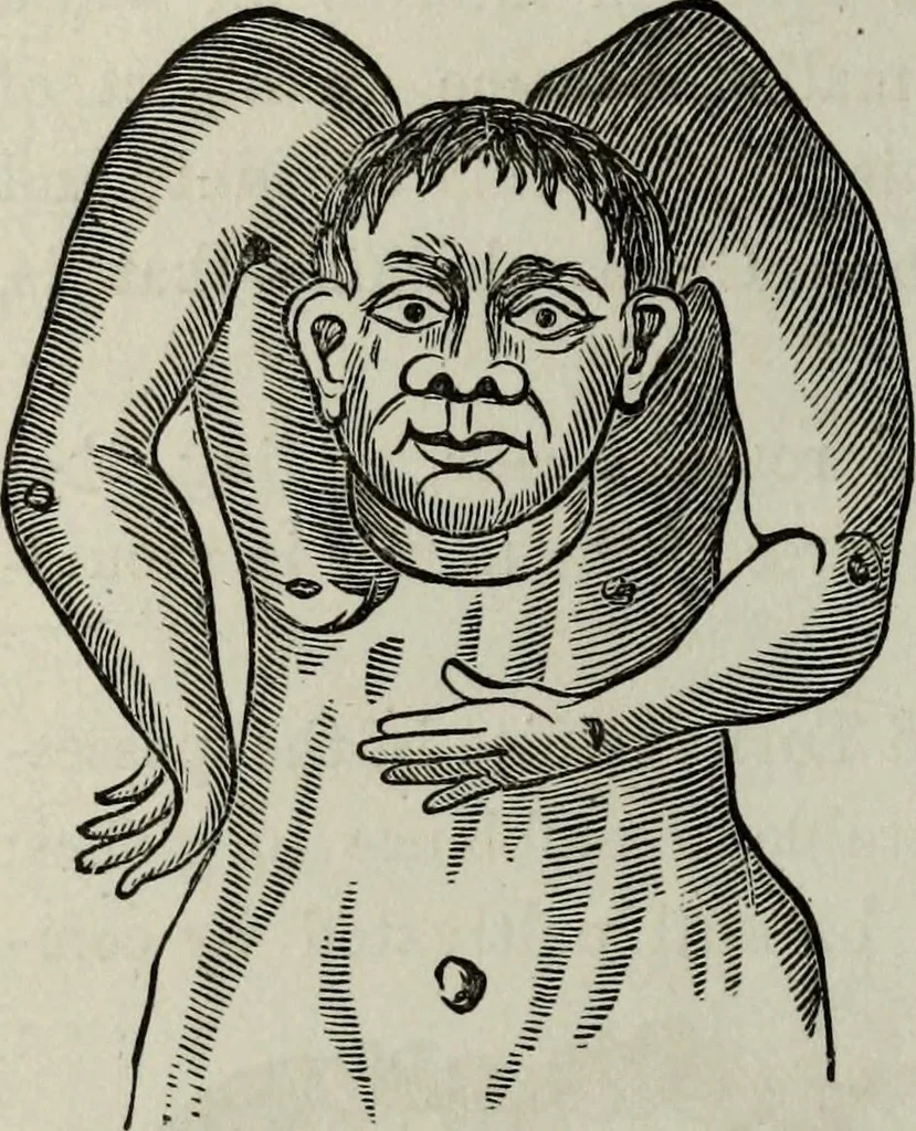 An illustration from Nature's revelations of character, or, Physiognomy illustrated : a description of the mental, moral and volitive dispositions of mankind, as manifested in the human form and countenance, 1887, leaf 541